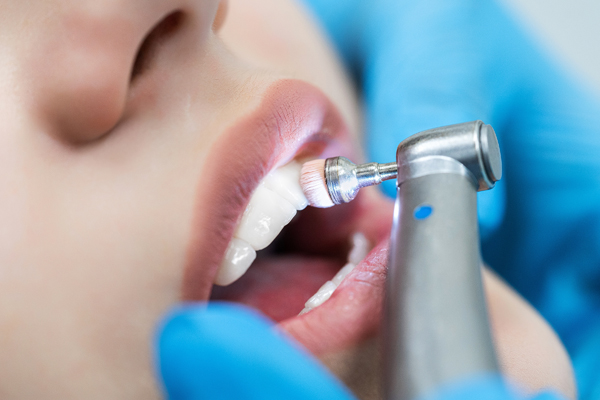 How To Care For Your Teeth Between Dental Cleanings