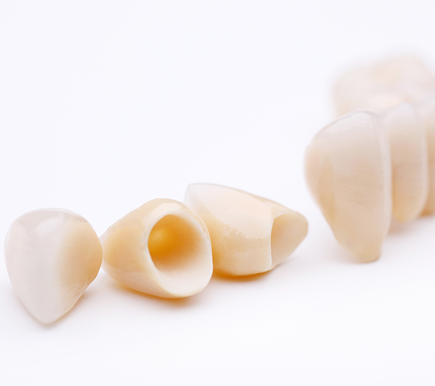 Milwaukie Dental Crowns and Dental Bridges
