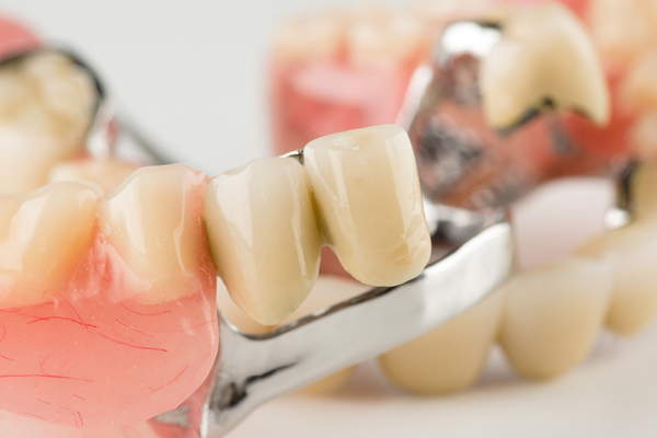 The Importance Of Partial Dentures