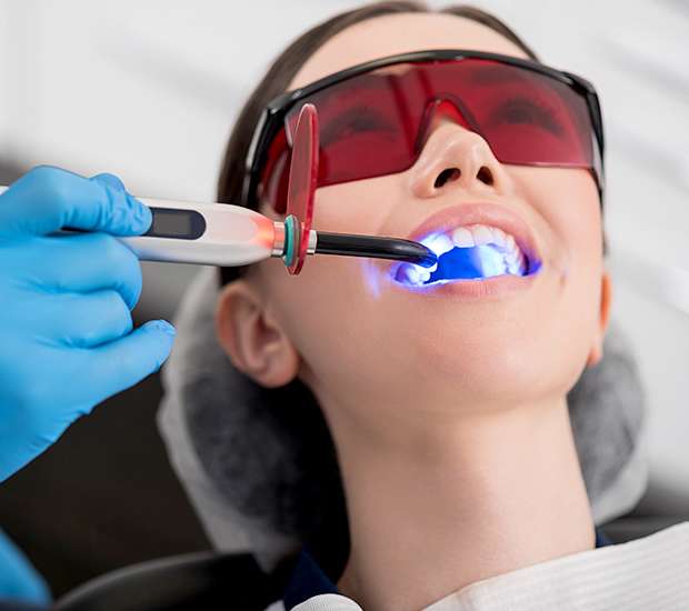 Milwaukie Professional Teeth Whitening